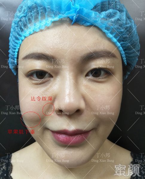 案例图片