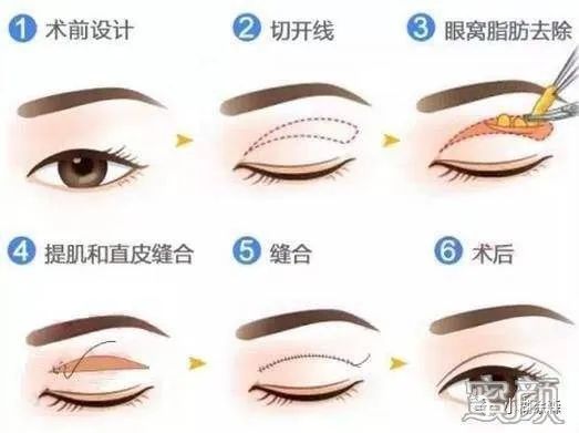 案例图片