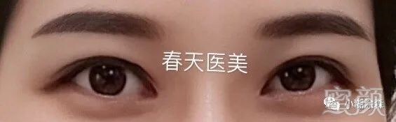 案例图片