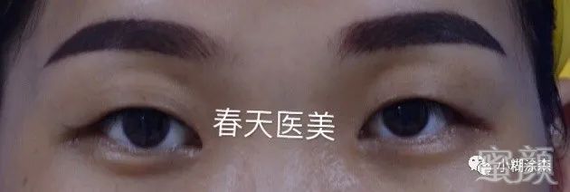 案例图片
