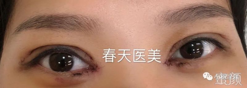 案例图片