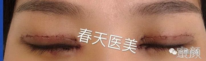 案例图片