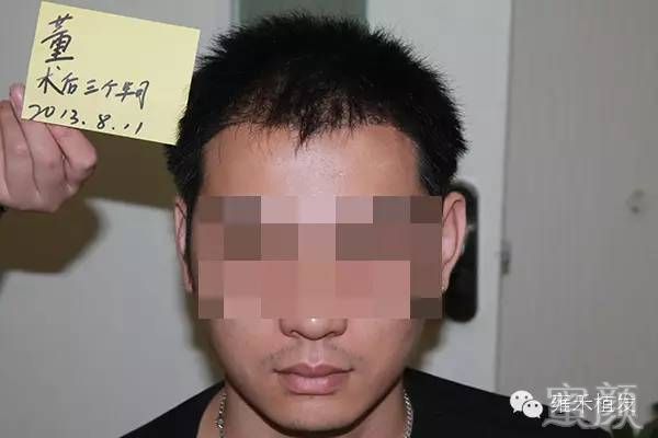 https://img.yiyiaimei.com/mnt/timg/200308/15455060N-8.jpg