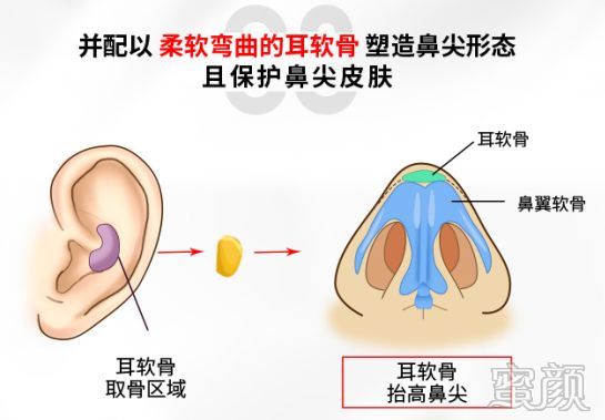 案例图片