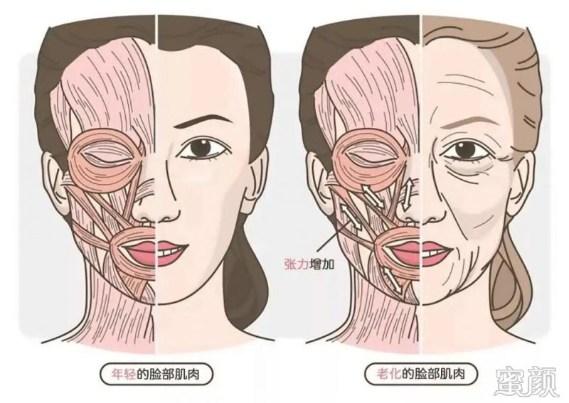 案例图片