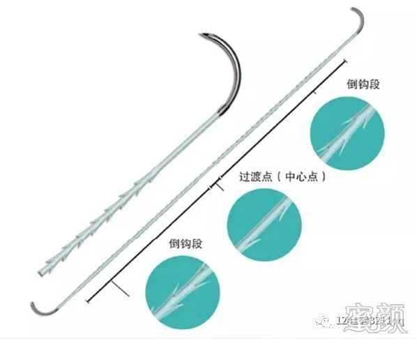 案例图片