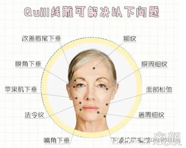案例图片