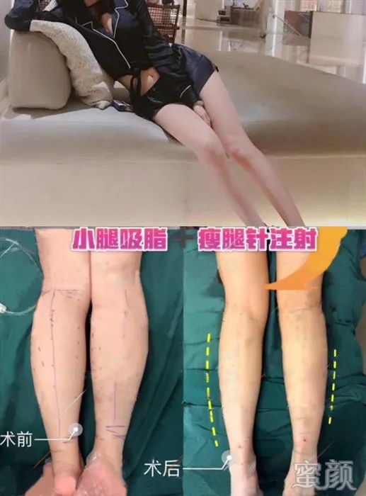 案例图片