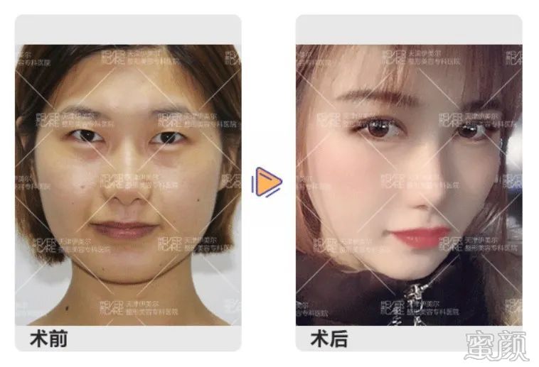 案例图片