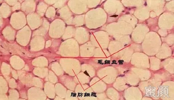https://img.yiyiaimei.com/mnt/timg/200310/131F91200-2.jpg