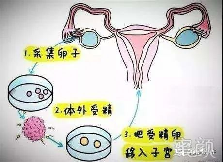 案例图片