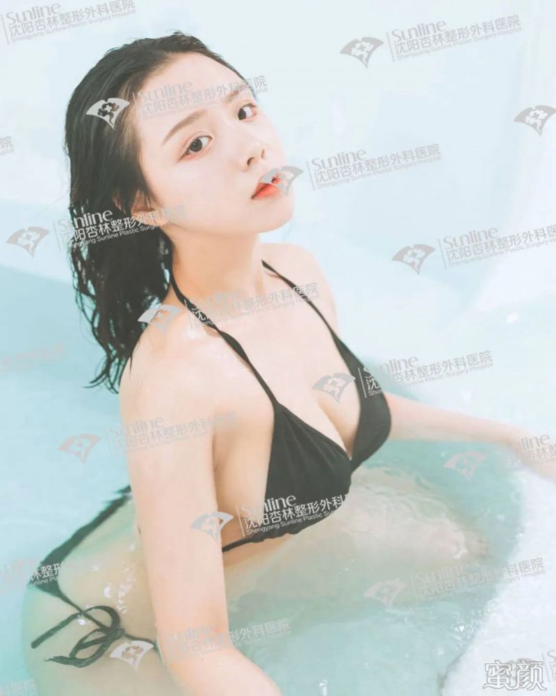 https://img.yiyiaimei.com/mnt/timg/200311/1314543X8-1.jpg 案例图片