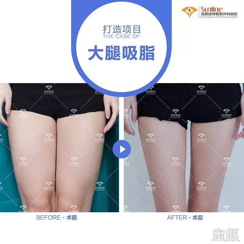 案例图片