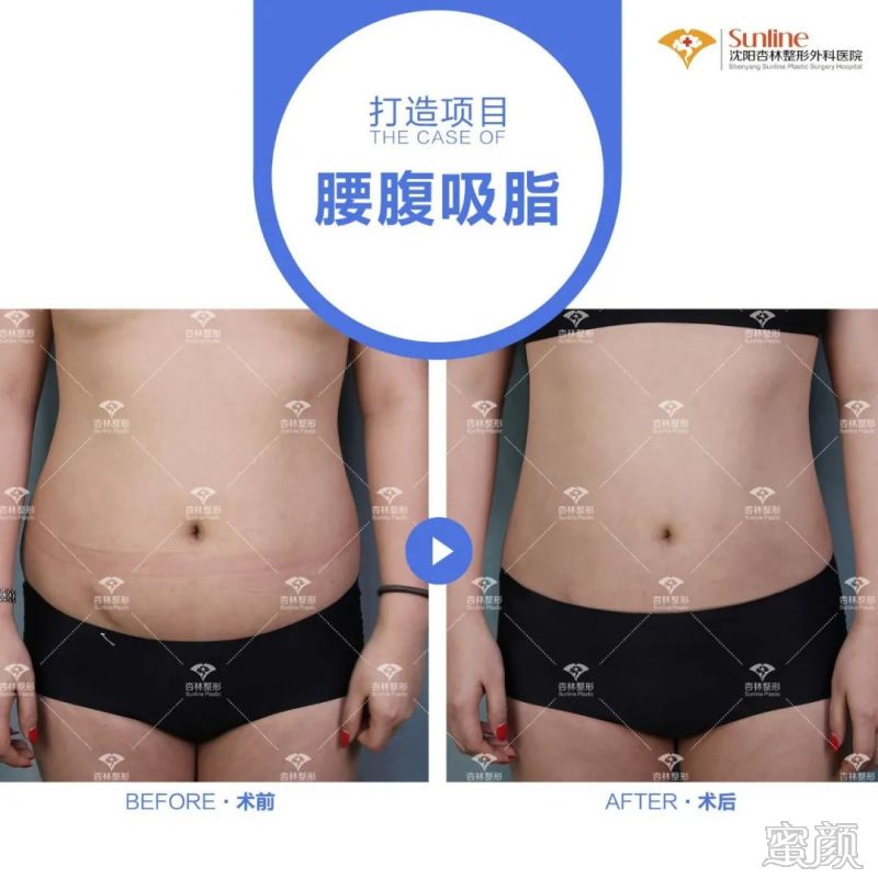 案例图片