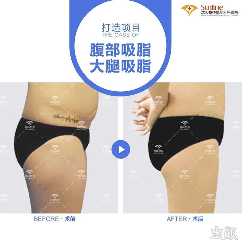 案例图片