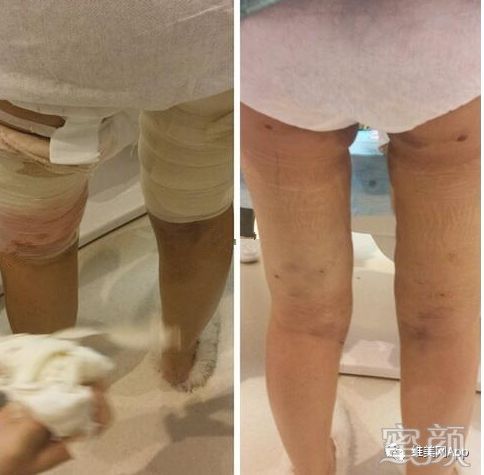 案例图片