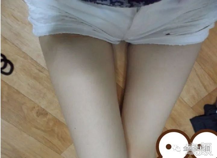 案例图片