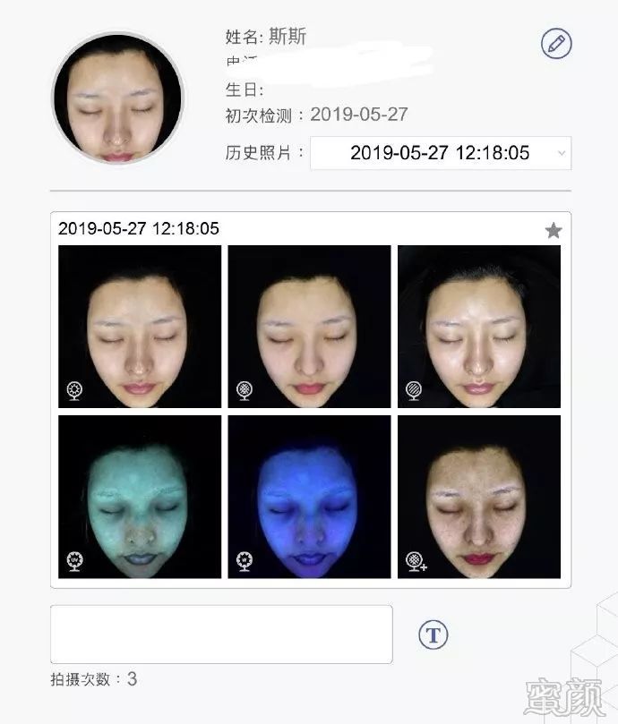 https://img.yiyiaimei.com/mnt/timg/200311/14031015U-3.jpg