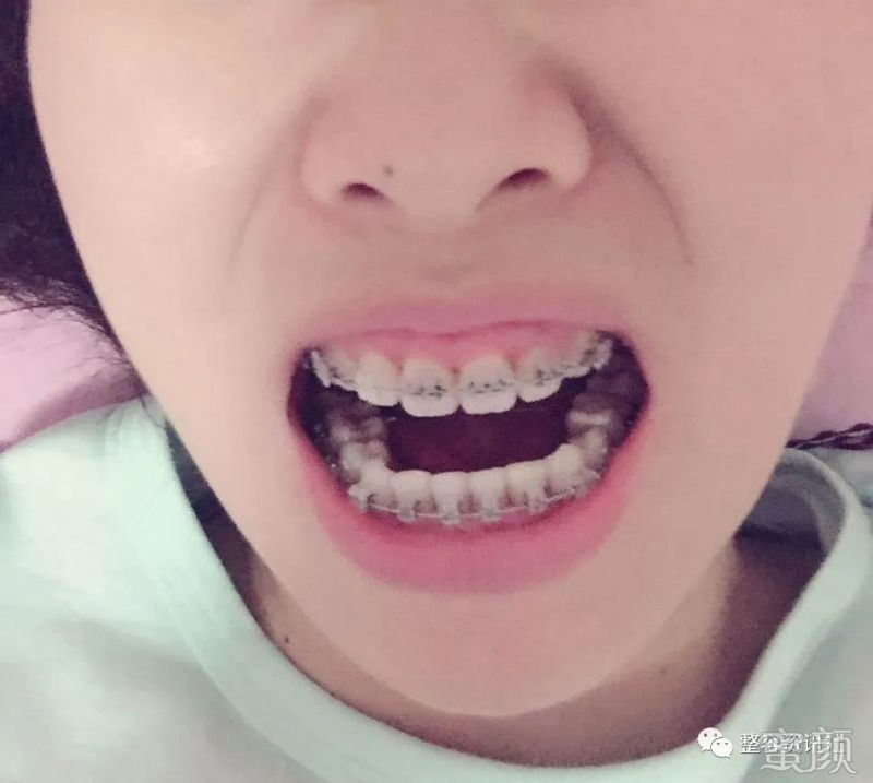 https://img.yiyiaimei.com/mnt/timg/200312/120U2LA-0.jpg