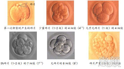 https://img.yiyiaimei.com/mnt/timg/200312/1316251525-5.jpg