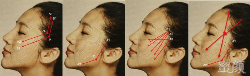 https://img.yiyiaimei.com/mnt/timg/200312/1335156441-2.jpg 案例图片