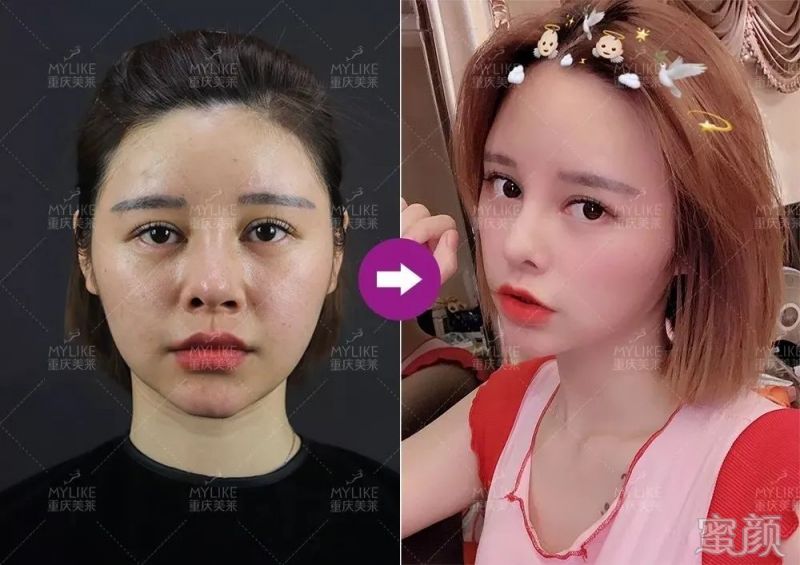 https://img.yiyiaimei.com/mnt/timg/200312/13351G2K-5.jpg 案例图片