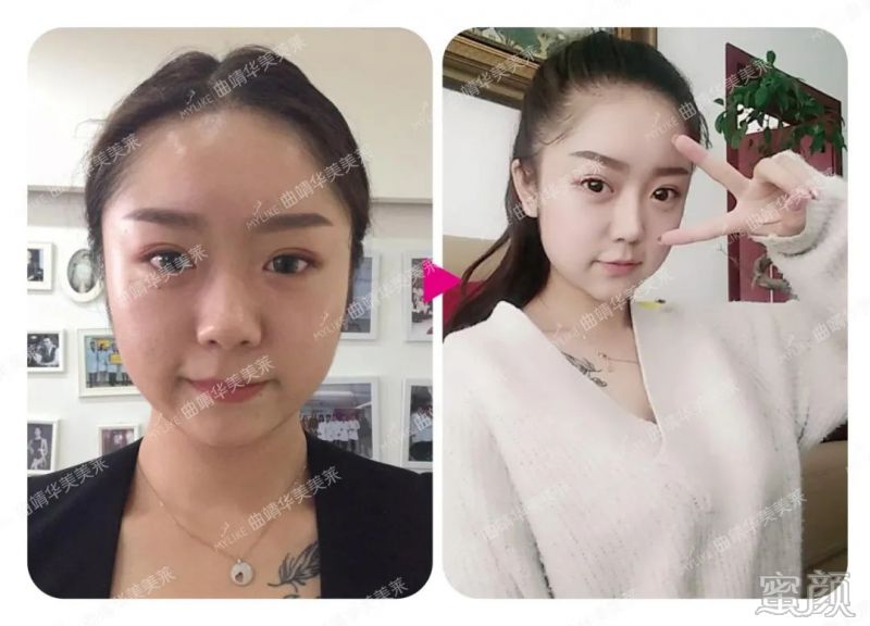 案例图片