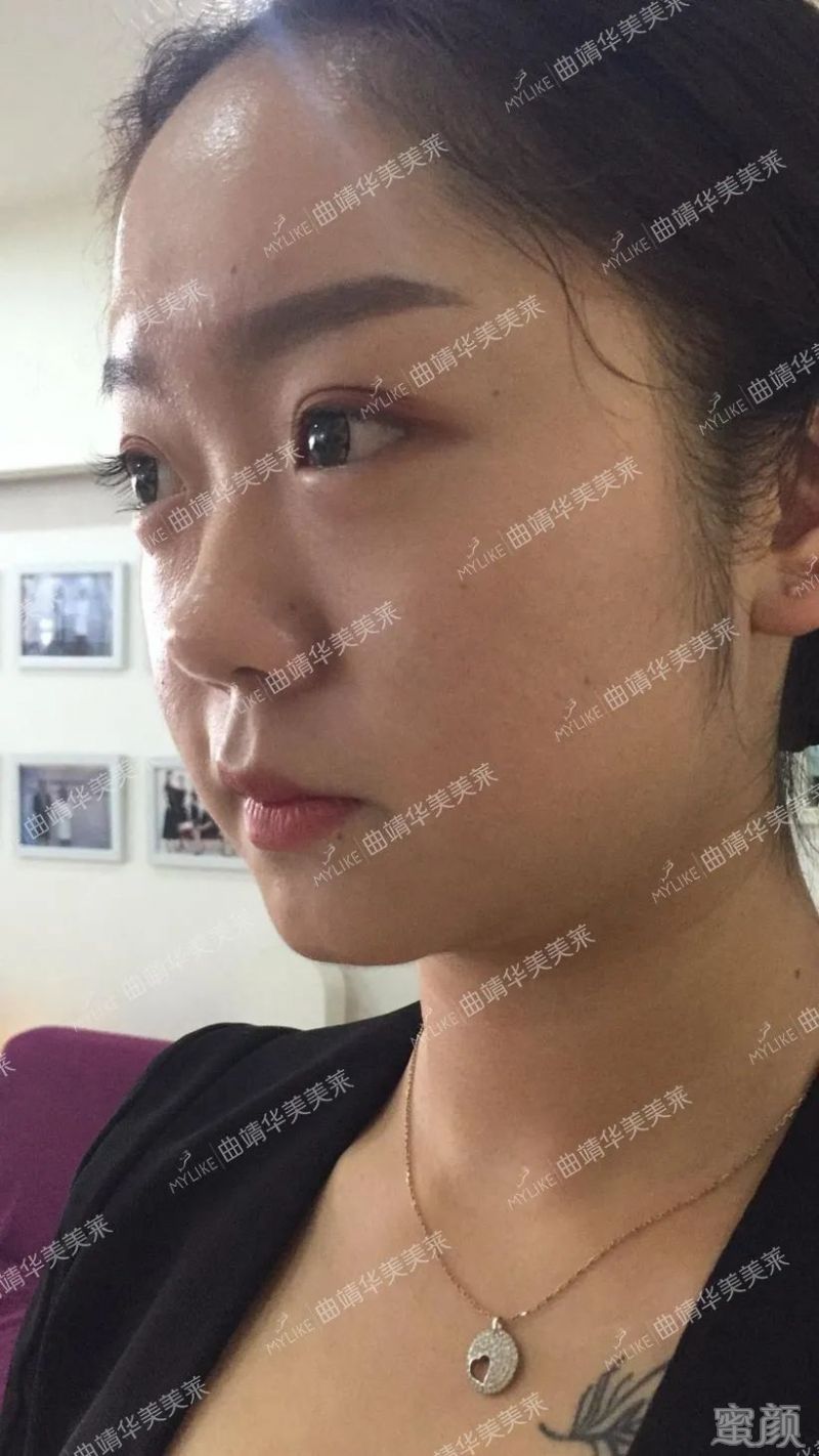 案例图片