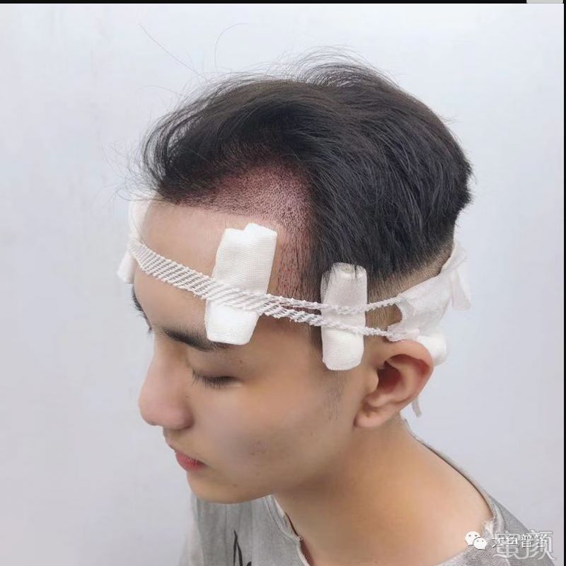 https://img.yiyiaimei.com/mnt/timg/200312/14193JY0-1.jpg