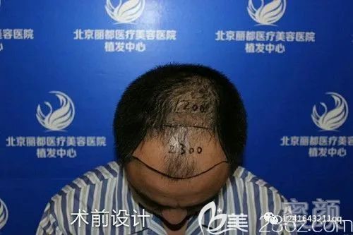 案例图片