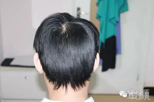 https://img.yiyiaimei.com/mnt/timg/200312/1436233a7-3.jpg 案例图片