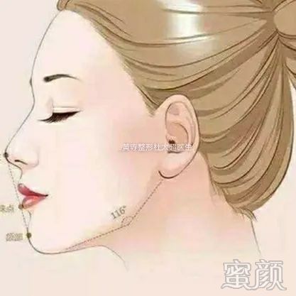 https://img.yiyiaimei.com/mnt/timg/200313/125J64340-0.jpg 案例图片