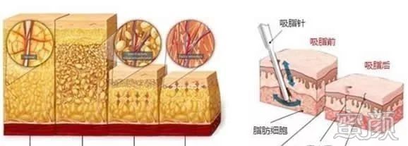 案例图片