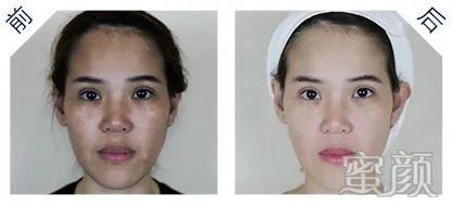 https://img.yiyiaimei.com/mnt/timg/200313/14113V115-4.jpg