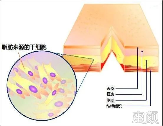 https://img.yiyiaimei.com/mnt/timg/200313/142054A11-1.jpg