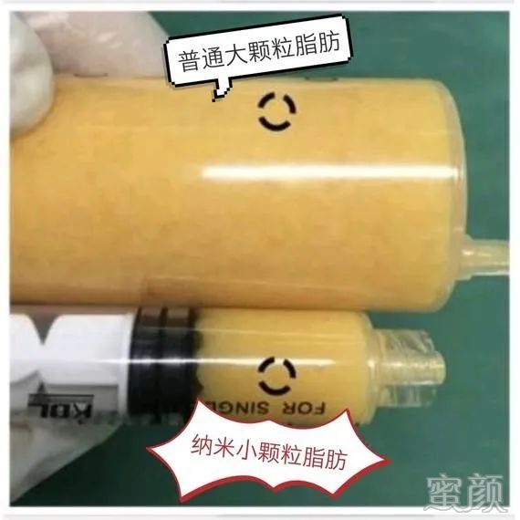 https://img.yiyiaimei.com/mnt/timg/200313/14205MJ3-5.jpg