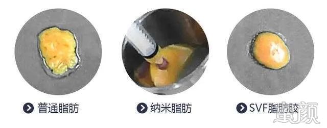 https://img.yiyiaimei.com/mnt/timg/200313/14205R105-7.jpg