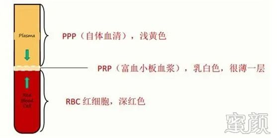 https://img.yiyiaimei.com/mnt/timg/200313/14205U349-9.jpg