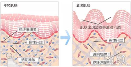 https://img.yiyiaimei.com/mnt/timg/200314/1409152Q3-4.jpg