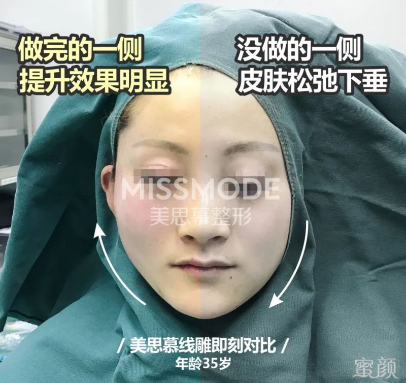 案例图片