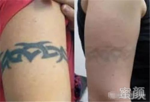 https://img.yiyiaimei.com/mnt/timg/200314/1531126457-8.jpg