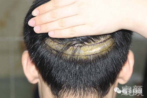 案例图片