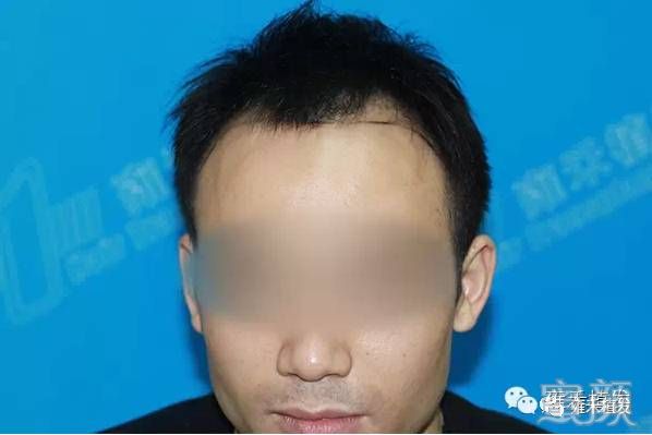 案例图片