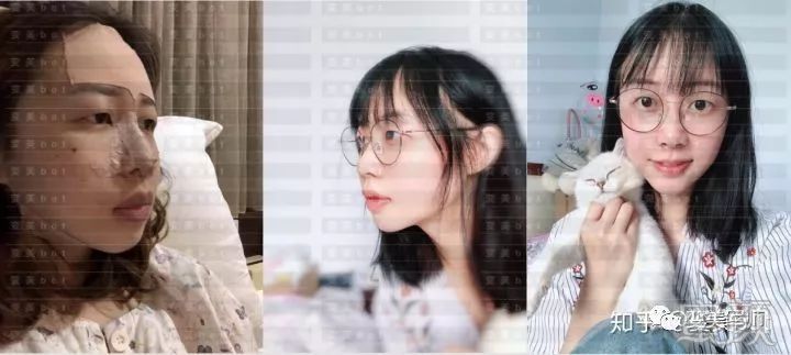 https://img.yiyiaimei.com/mnt/timg/200315/151SL137-12.jpg