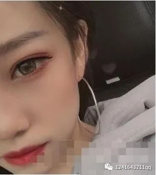 案例图片