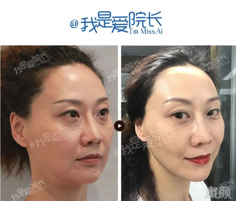 案例图片