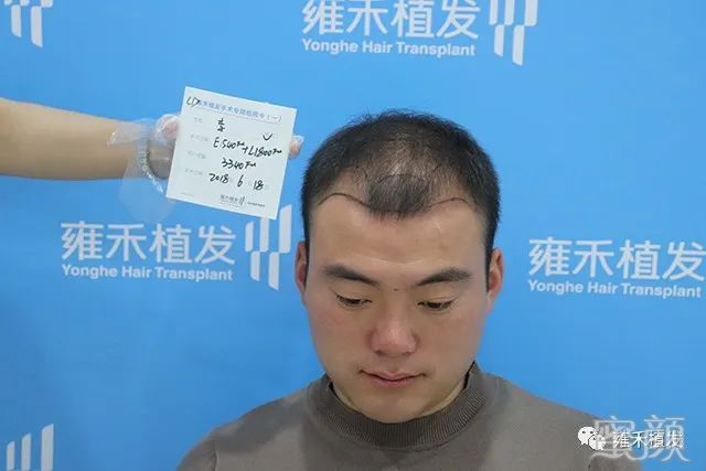 https://img.yiyiaimei.com/mnt/timg/200316/14255920V-1.jpg
