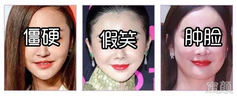 https://img.yiyiaimei.com/mnt/timg/200316/142921D38-1.jpg