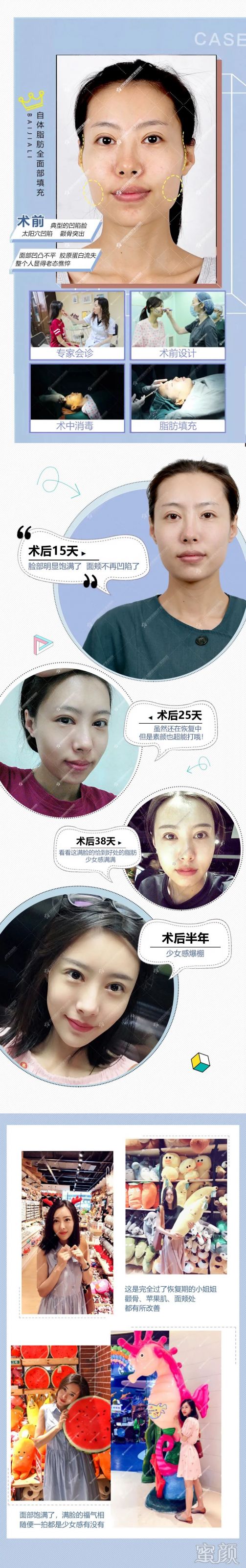 https://img.yiyiaimei.com/mnt/timg/200316/1429235U3-2.jpg