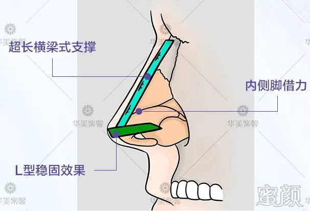 案例图片